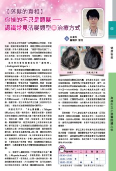 【落髮的直相】你掉的不只是頭髮-認識常見落髮類型與治療方式