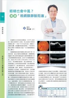 眼睛也會中風?淺談「視網膜靜脈阻塞」