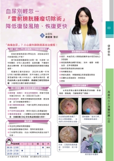 血尿別輕忽-『雷射膀胱腫瘤切除術』降低復發風險、恢復更快